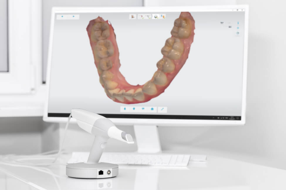 digital image of a mouth on a computer screen thanks to digital dentistry from a dental lab serving the US and Canada