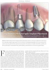 Implant Placement
