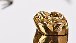 National Dentex Full Cast Dental Crowns