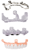 Implant Restorations