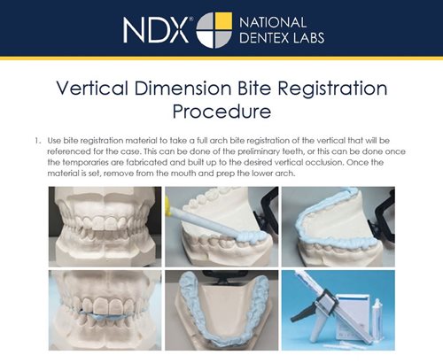Vertical Dimension Bite Registration Procedure bulletin produced by a dental lab serving the US and Canada